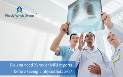 Do I need X-ray or MRI reports before seeing a physiotherapist?