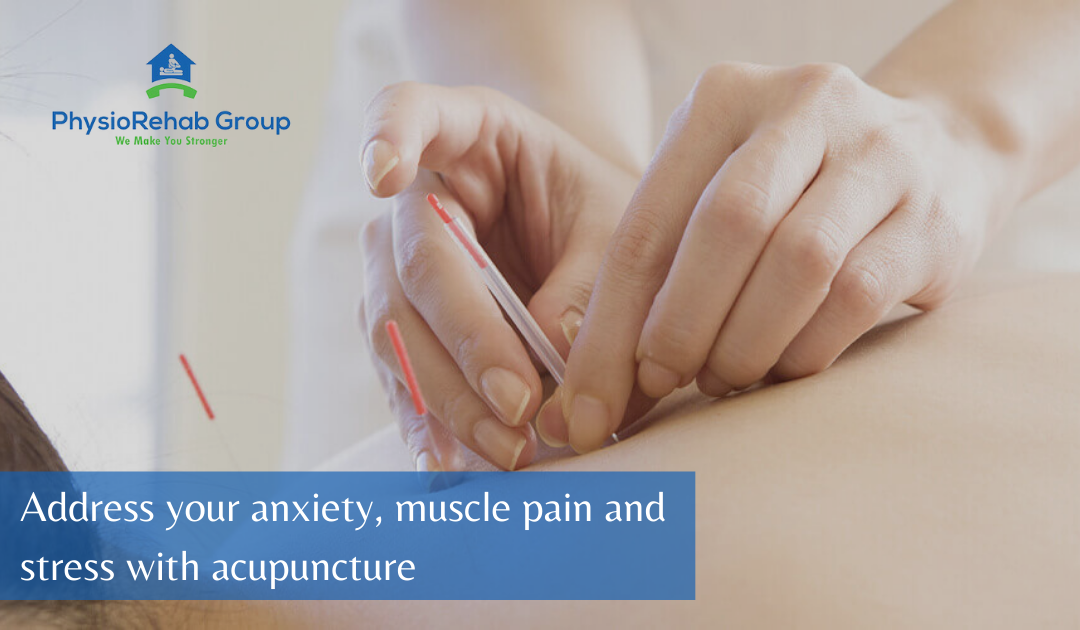 Address your anxiety, muscle pain and stress with Acupuncture