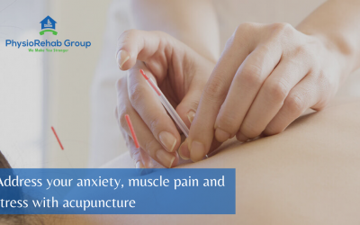 Address your anxiety, muscle pain and stress with Acupuncture