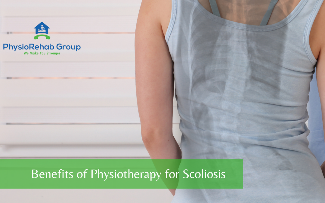 Benefits of Physiotherapy for Scoliosis