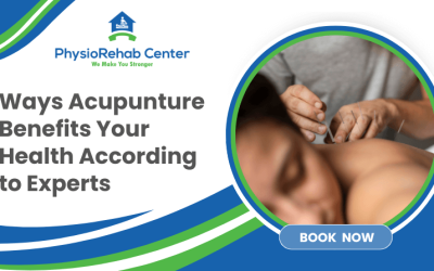 Ways Acupuncture Benefits Your Health According to Experts